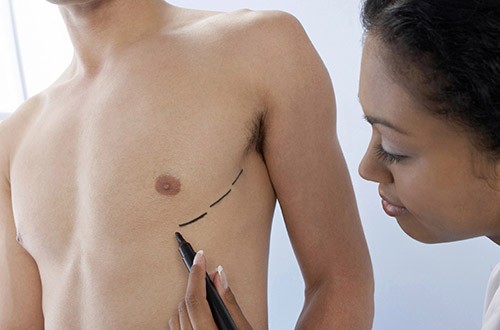 Странные пластические операции