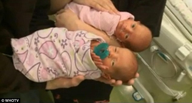 Женщина не подозревала о своей беременности, пока не родила близнецов 