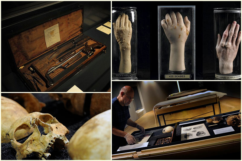 Доктора, расчленители и воскресители