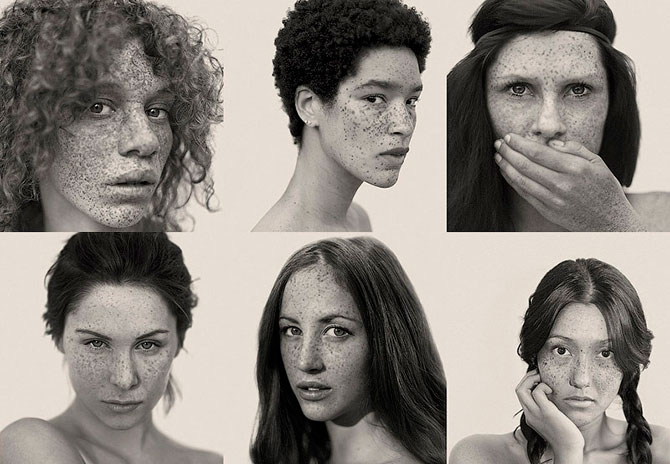 Веснушки это красиво