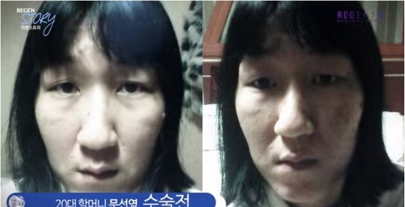 Чудеса корейской хирургии