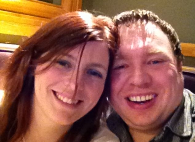 Спонтанные отеки у женщины из-за наследственного отека Квинке