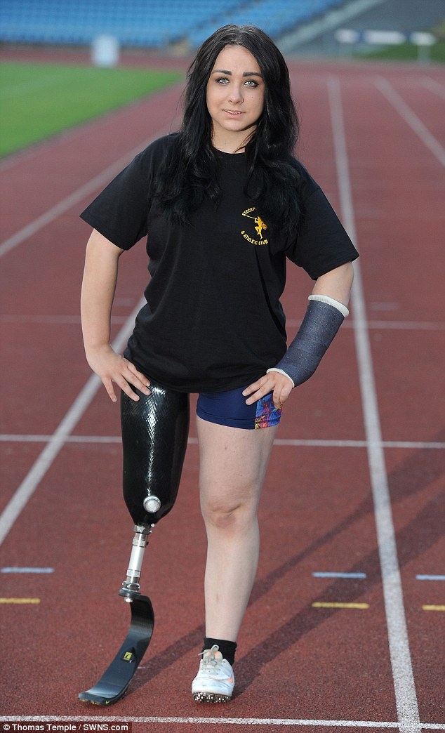 Зачем юная бегунья-инвалид просит врачей ампутировать ей вторую ногу 